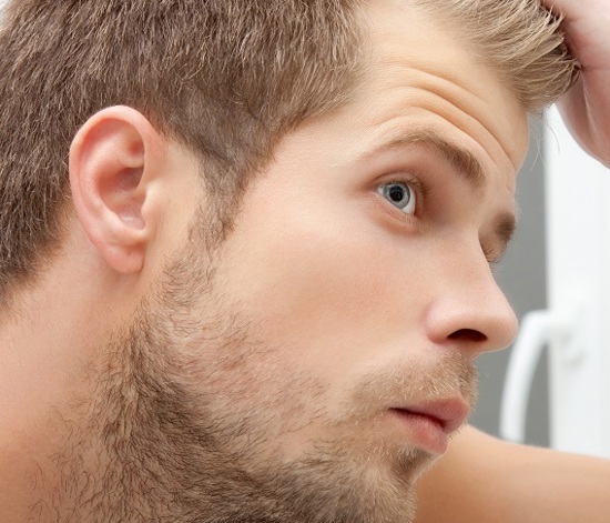 Erkek tipi saç dökülmesi nedir ve nasıl önlenir?