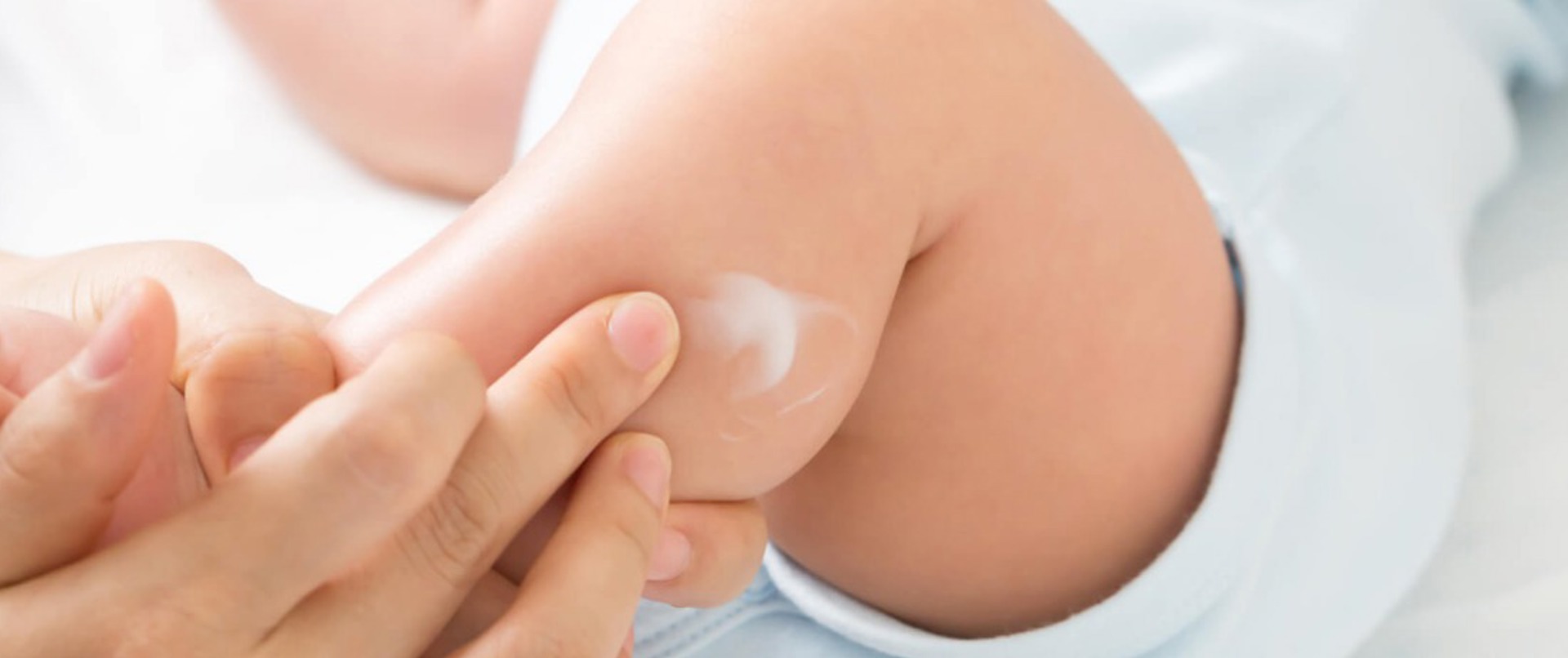 Bebeklerde Atopik Dermatit Nedir? 